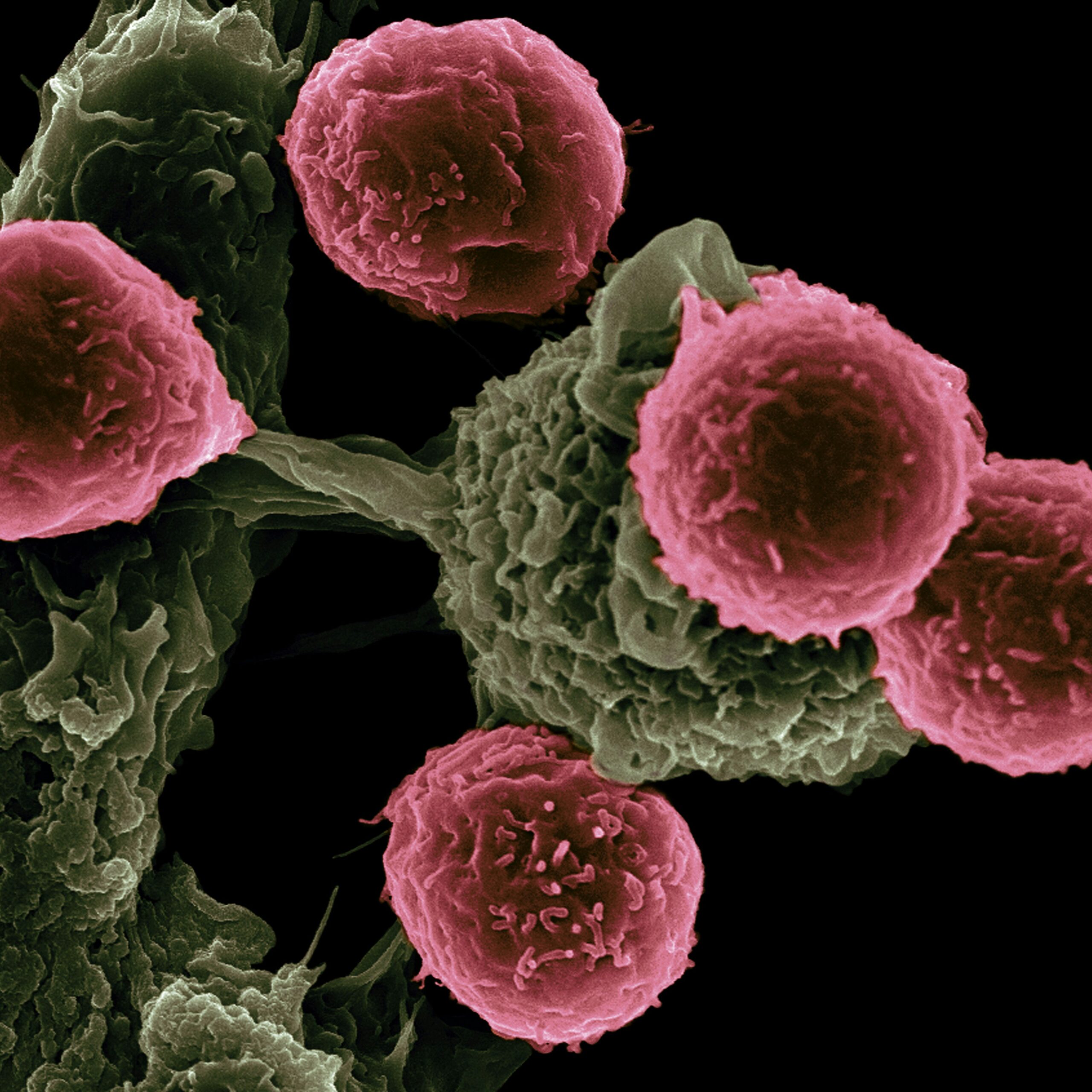 Heterogeneidade do microambiente tumoral desafia resistência terapêutica de célula cancerosa
