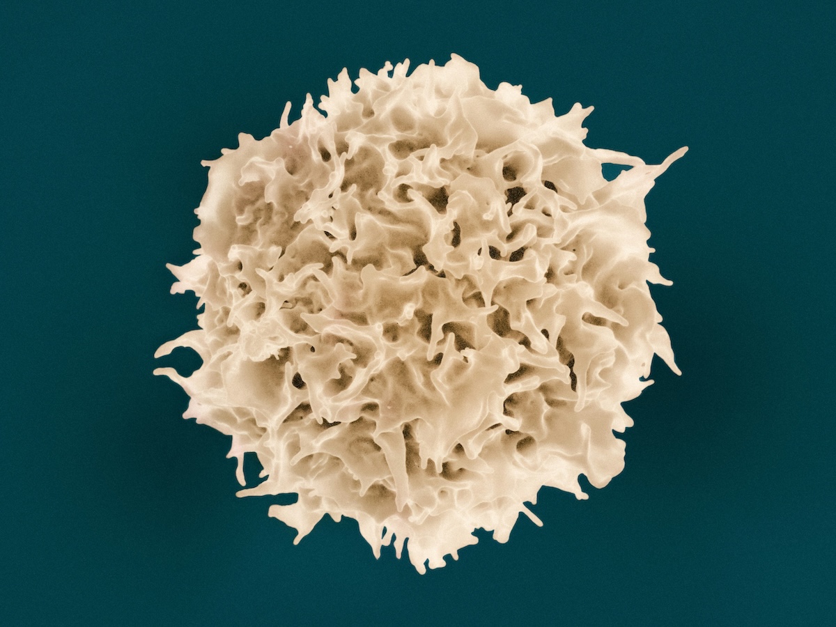 Imagem de microscopia eletrônica de varredura mostrando uma célula T humana isolada, em tons bege sobre fundo azul-esverdeado escuro. A célula tem formato aproximadamente esférico, com superfície irregular coberta por dobras, projeções e reentrâncias características do tipo celular.