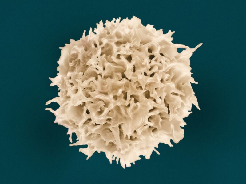 Scanning electron micrograph of an isolated human T cell, shown in beige against a dark background. The cell is roughly spherical, with an irregular surface covered in folds, protrusions, and indentations characteristic of this cell type.