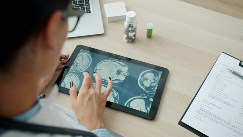 Fotografia vertical, vista de cima, mostra uma mulher de cabelo escuro preso e óculos de grau, vestindo blusa azul-clara, sentada a uma mesa de madeira clara. Com as unhas pintadas de preto, ela toca a tela de um tablet que exibe imagens de ressonância magnética do cérebro. Ao redor, sobre a mesa, veem-se um notebook aberto, dois potes de comprimidos coloridos e uma prancheta com uma ficha médica impressa em inglês.
